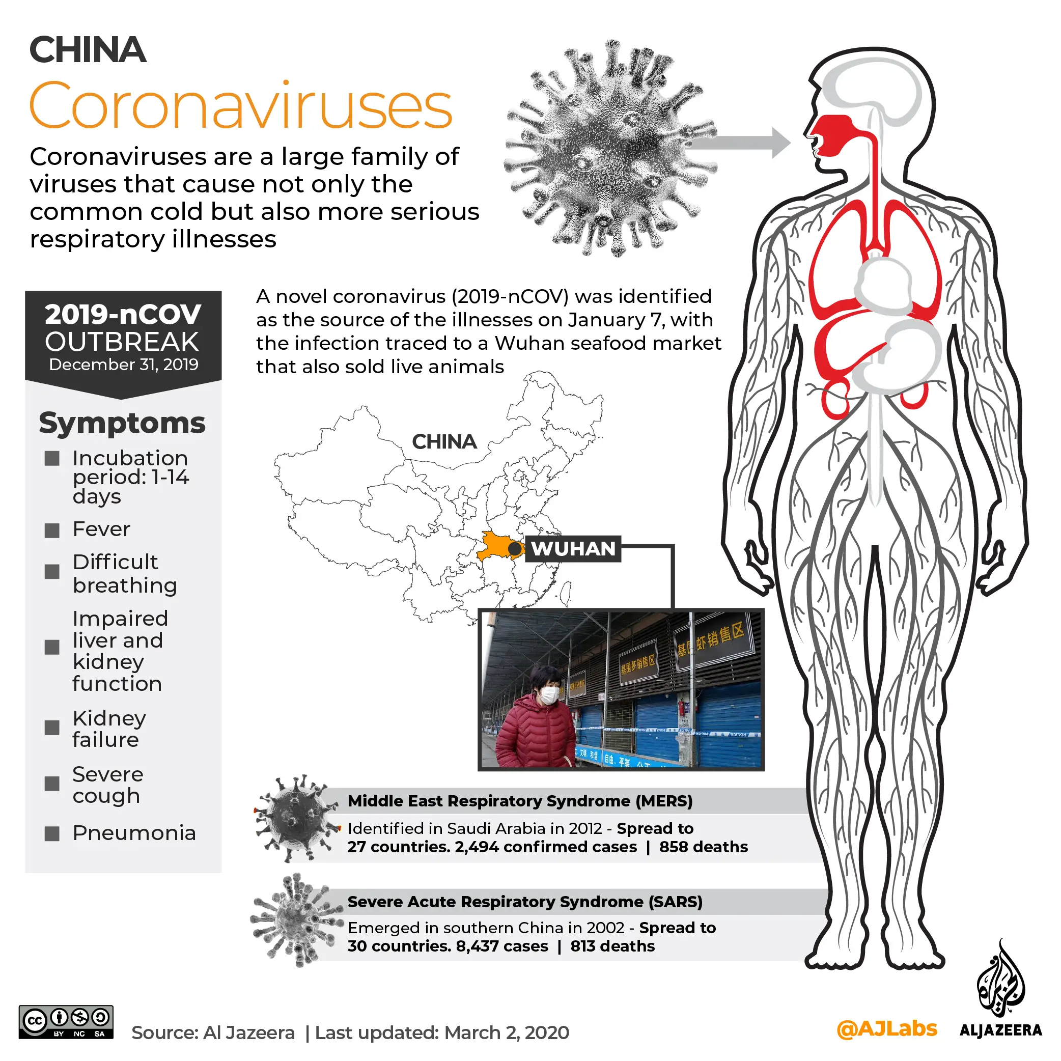 Worst still to come in US coronavirus outbreak: Expert